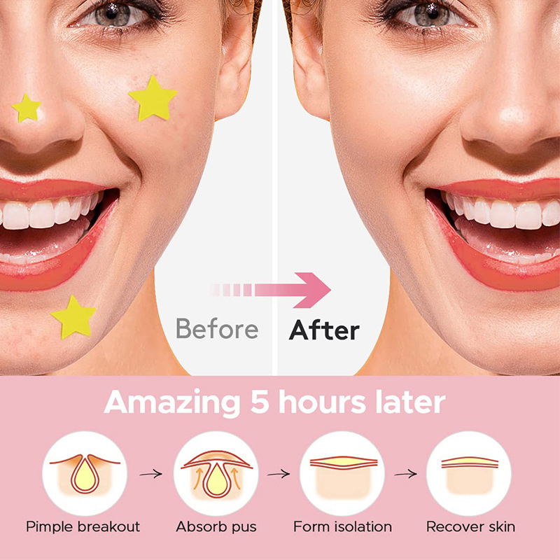 600 PCS/Set Star Pimple Patch  - Beauty Makeup Face ulasan dan harga