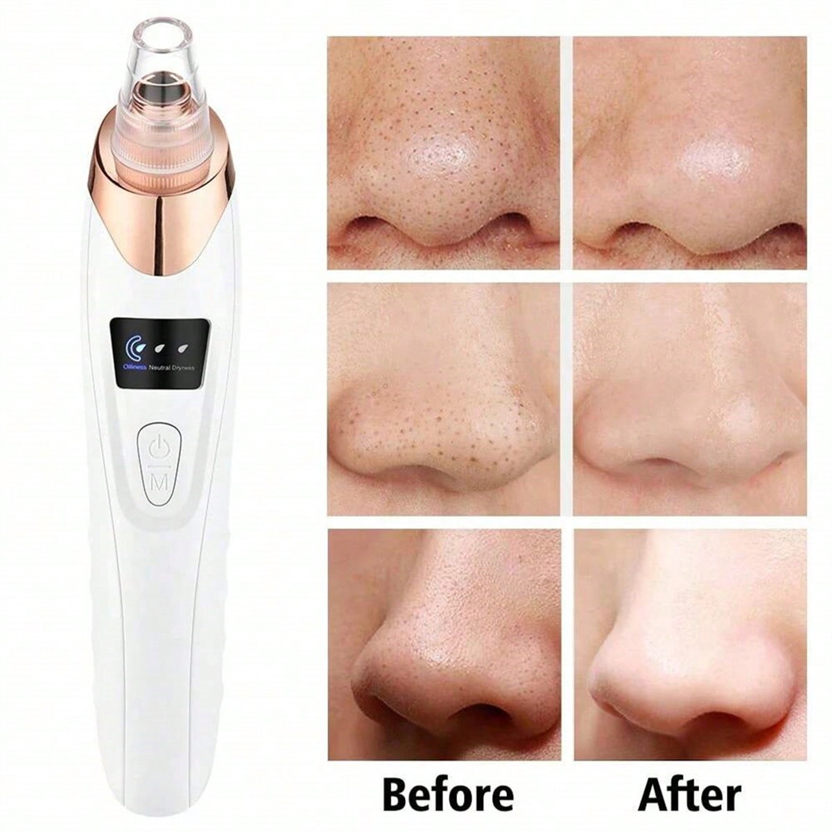 2026 Facial Pore Cleaner, 5 Su - Pore Vacuum ulasan dan harga