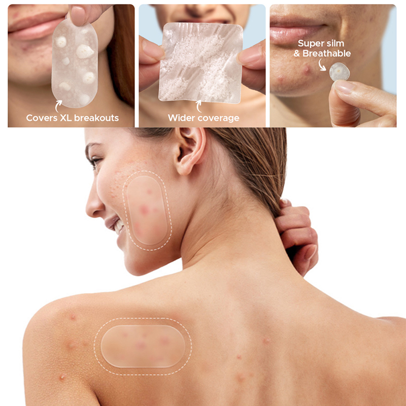 116Pcs Anti-Acne Patches Spots - Pressed Powder Foundation ulasan dan harga