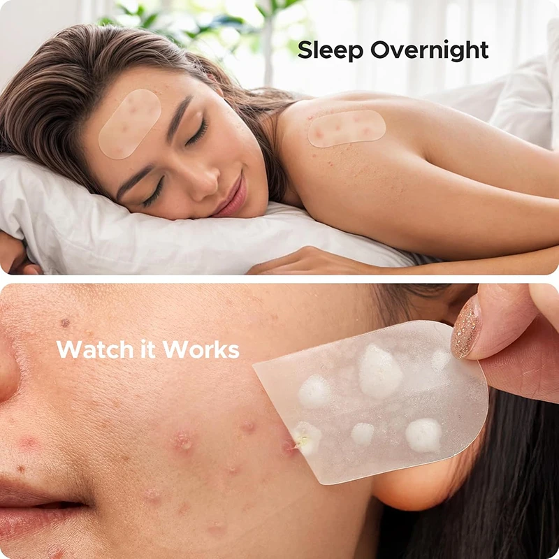 116Pcs Anti-Acne Patches Spots - Pressed Powder Foundation ulasan dan harga