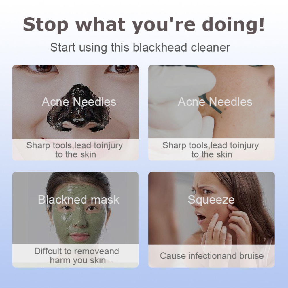 Electric Blackhead Remover 3 S - Pore Vacuum ulasan dan harga