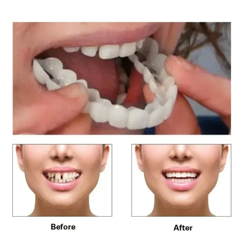 Fake Tooth Cover Perfect Fit T - Beauty Makeup News ulasan dan harga