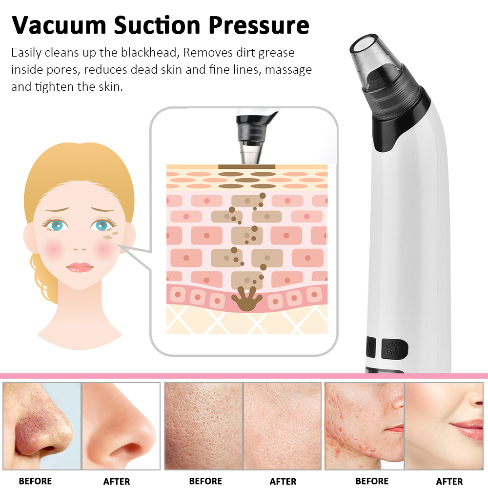 Blackhead Remover Electric Fac - Pore Vacuum ulasan dan harga