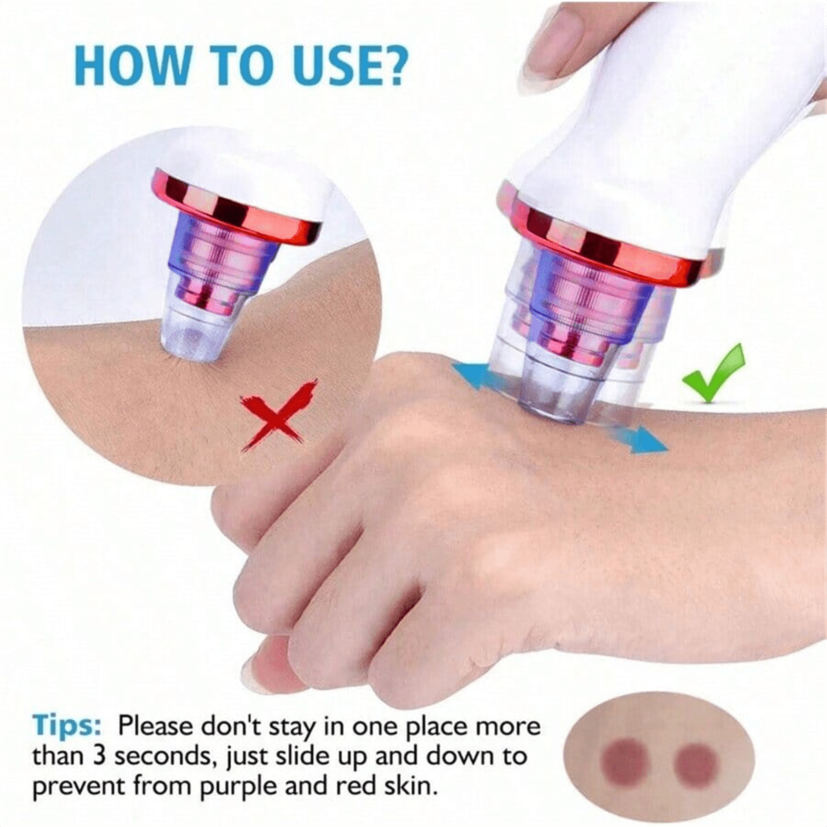 2026 Blackhead Remover Pimple  - Pore Vacuum ulasan dan harga