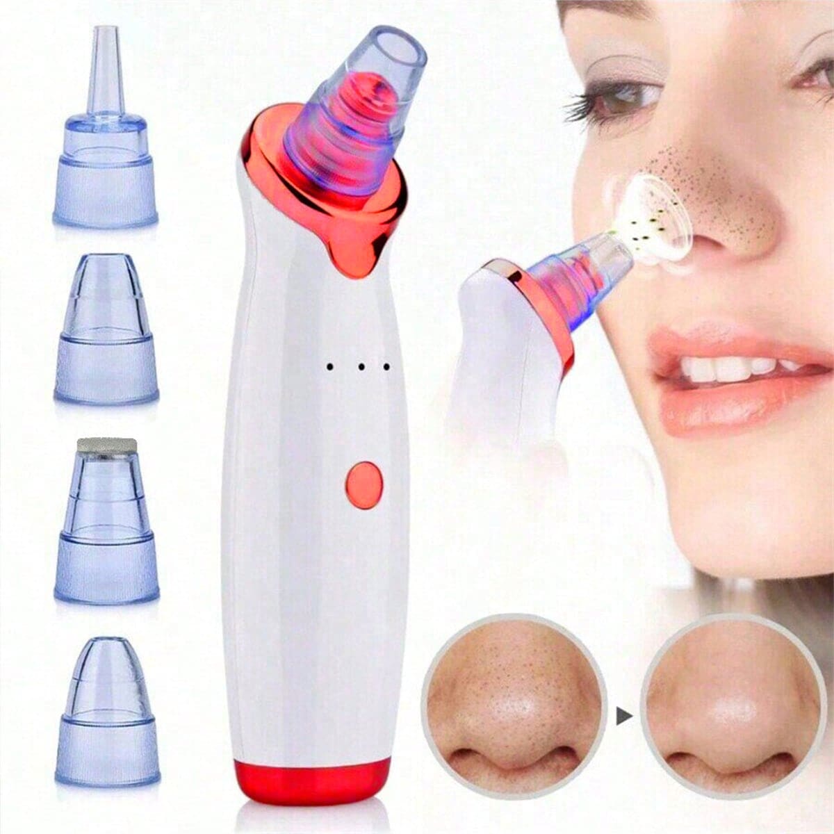 2026 Blackhead Remover Pimple  - Pore Vacuum ulasan dan harga