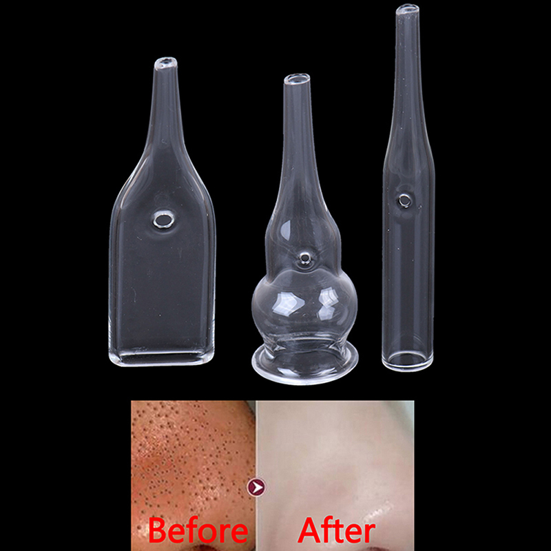 3Pcs/Set Blackhead Removal Gla - Pore Vacuum ulasan dan harga