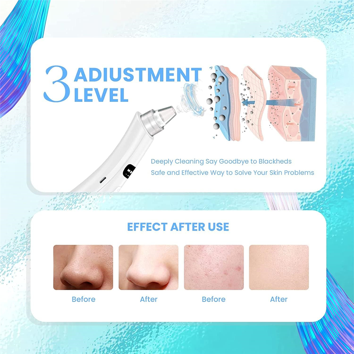 Blackhead Remover Pore Vacuum, - Pore Vacuum ulasan dan harga